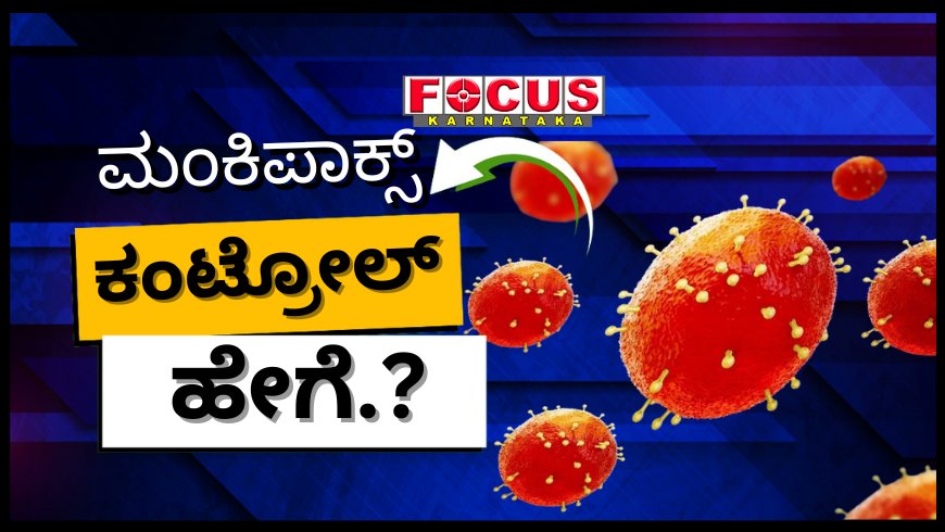 ಮಂಕಿಪಾಕ್ಸ್ ತಡೆಯುವುದು ಹೇಗೆ ? ವಿಸ್ತೃತ ವರದಿ.