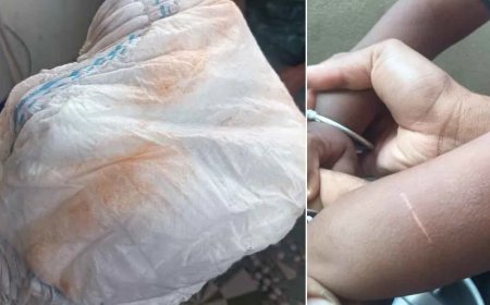 ಛೇ.. ಹಠ ಮಾಡ್ತಿದ್ದ ಮಗುವಿನ ಕೈಗೆ ಬರೆ, ಡೈಪರ್‌ʼಗೆ ಖಾರದ ಪುಡಿ ಹಾಕಿ ವಿಕೃತಿ..!