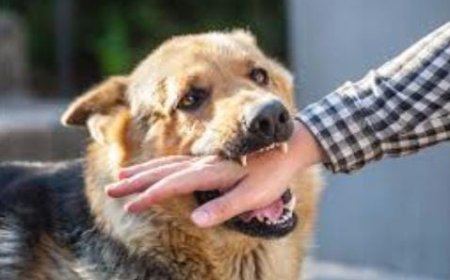 ಚಿಕಿತ್ಸೆ ಪಡೆಯದೇ ನಿರ್ಲಕ್ಷ್ಯ: ನಾಯಿ ಕಚ್ಚಿ 15 ದಿನದ ಬಳಿಕ ರೇಬಿಸ್ ಗೆ ತುತ್ತಾದ ಮಹಿಳೆ!