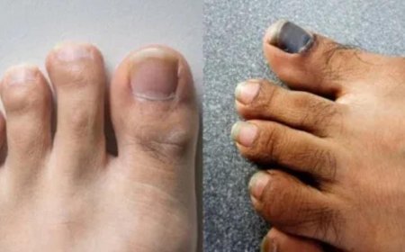 ಬೆರಳುಗಳ ಮೇಲೆ ಕೂದಲು ಇದ್ರೆ ಅದೃಷ್ಟಾನಾ? ಶಾಸ್ತ್ರಗಳು ಹೇಳೋದೇನು?