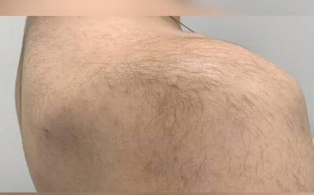 ಬೆನ್ನಿನ ಮೇಲೆ ಕೂದಲು ಇದ್ರೆ ಅದೃಷ್ಟವಂತರೇ? ನೀವು ತಿಳಿಯಲೇಬೇಕು!