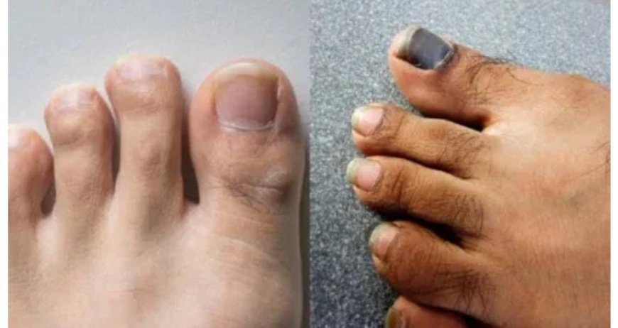 ಬೆರಳುಗಳ ಮೇಲೆ ಕೂದಲು ಇದ್ರೆ ಅದೃಷ್ಟಾನಾ? ಶಾಸ್ತ್ರಗಳು ಹೇಳೋದೇನು?