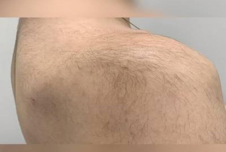 ಬೆನ್ನಿನ ಮೇಲೆ ಕೂದಲು ಇದ್ರೆ ಅದೃಷ್ಟವಂತರೇ? ನೀವು ತಿಳಿಯಲೇಬೇಕು!