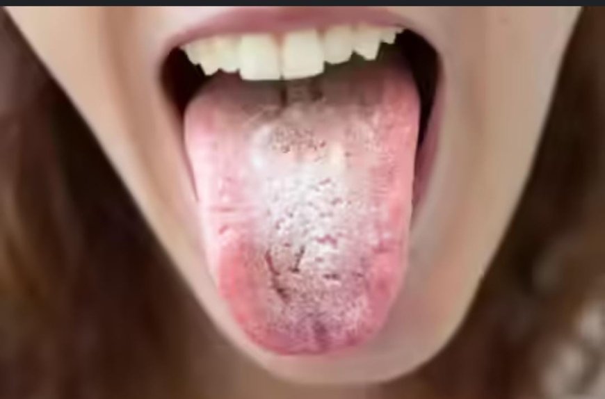 ನಾಲಿಗೆಯ ಬಣ್ಣವೇ ದೇಹದ ಆರೋಗ್ಯದ ಸೂಚನೆ! ನೀವು ಹೀಗೆ ತಿಳಿಯಬಹುದು